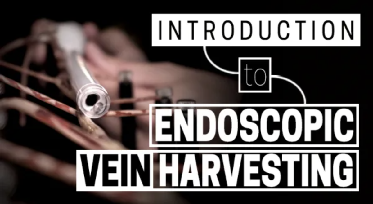 Introduction to Endoscopic Vein Harvesting IAC